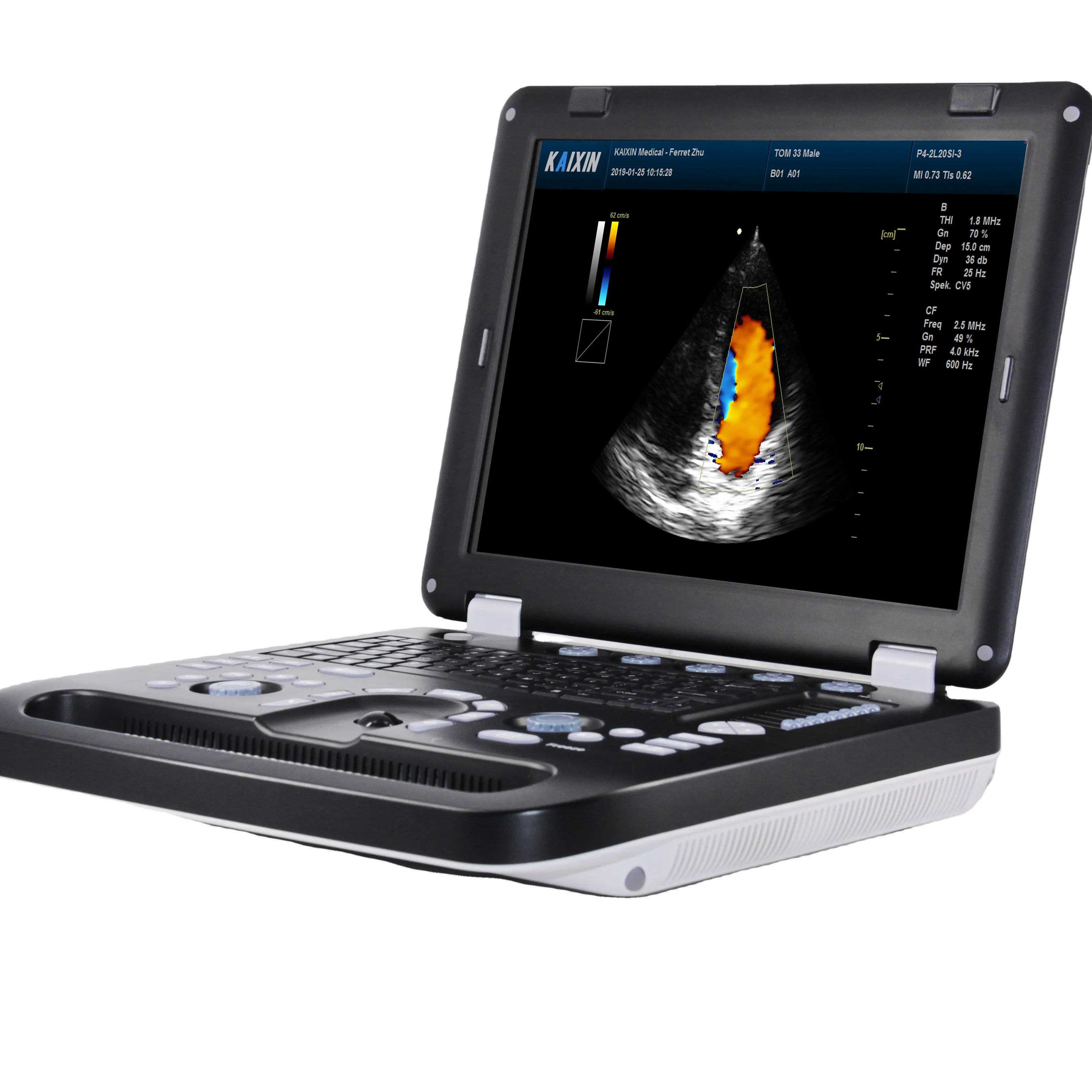 Hospital clinic medical for different body parts ultrasound probe 3D 4D color doppler ultrasound scanner machine  instrument
