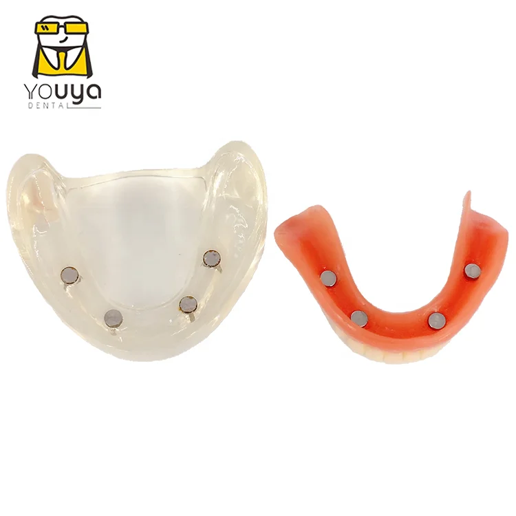 Resin Dental Tooth Model Dental Implant Model Dental Teaching Model