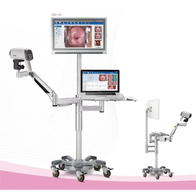 EDAN C6HD оригинальный HD видео кольпоскоп производители