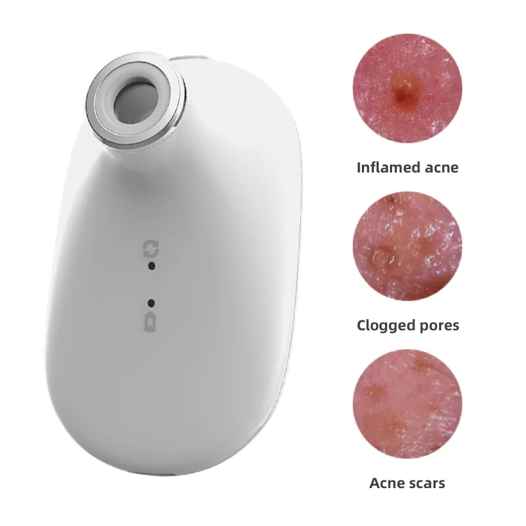 Professional facial skin analyzer facial analysis high definition skin analyzer machine