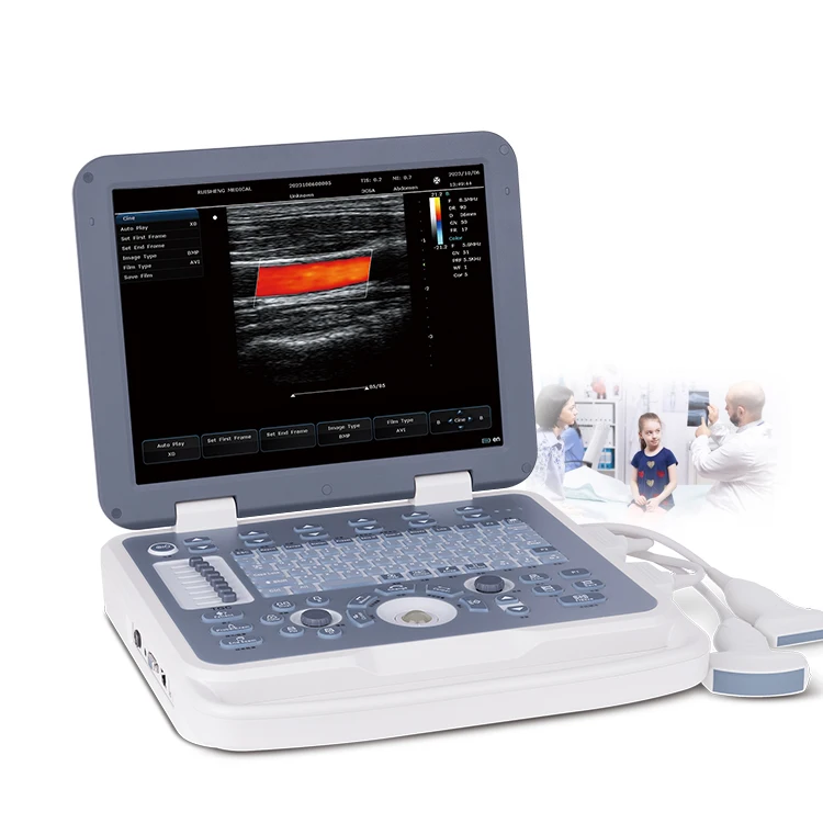 N30 Most Popular Black White Portable Color Doppler Ultrasound Scanner Ecografia Portatil Hand Carried Laptop Ultrasonido Device