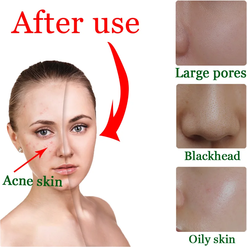 OEM private label korea cosmetic nourish facial green deep clean mask stick