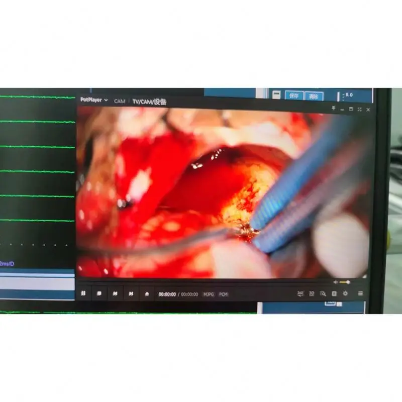 medical IONM system nerve monitoring systems for ENT/thyroid surgery for sale surgical equipment