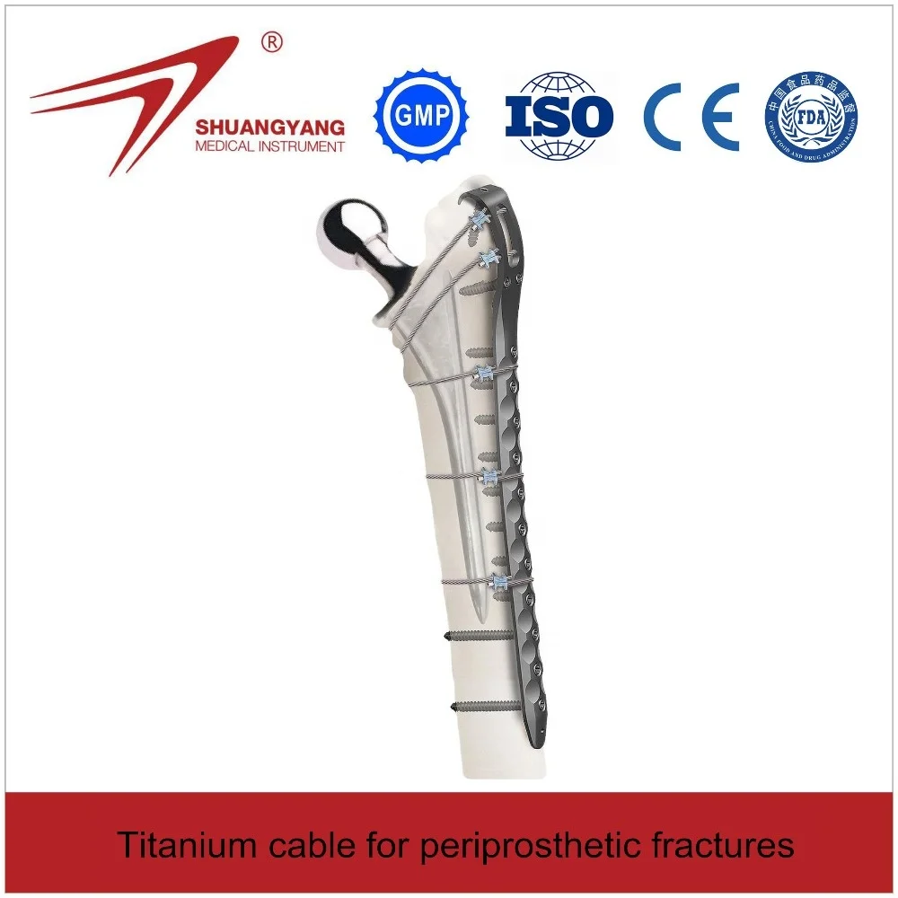 Titanium cable and locking plate Implant for Orthopedic femur fractures (Cerclage Wire)