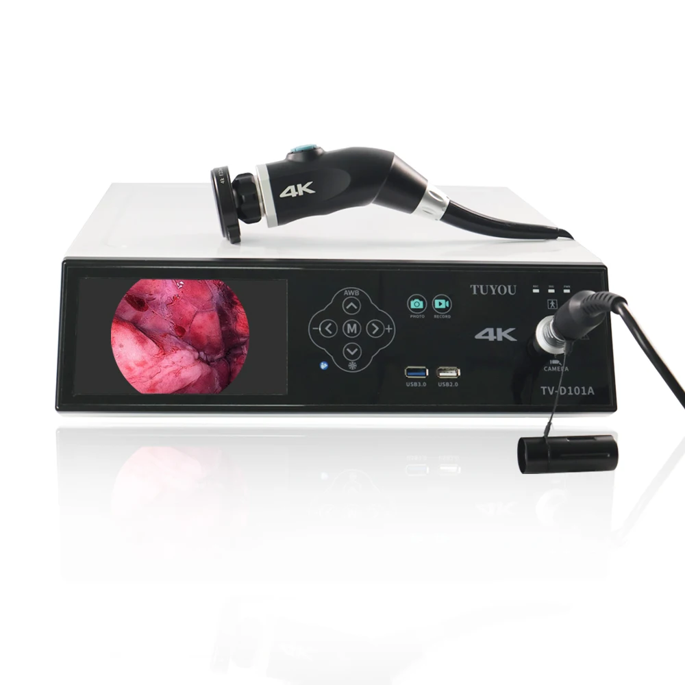 TUYOU Hot Sale Urology ENT 1080P Endoscopic Imaging System HD Endoscopy Medical Endoscopy