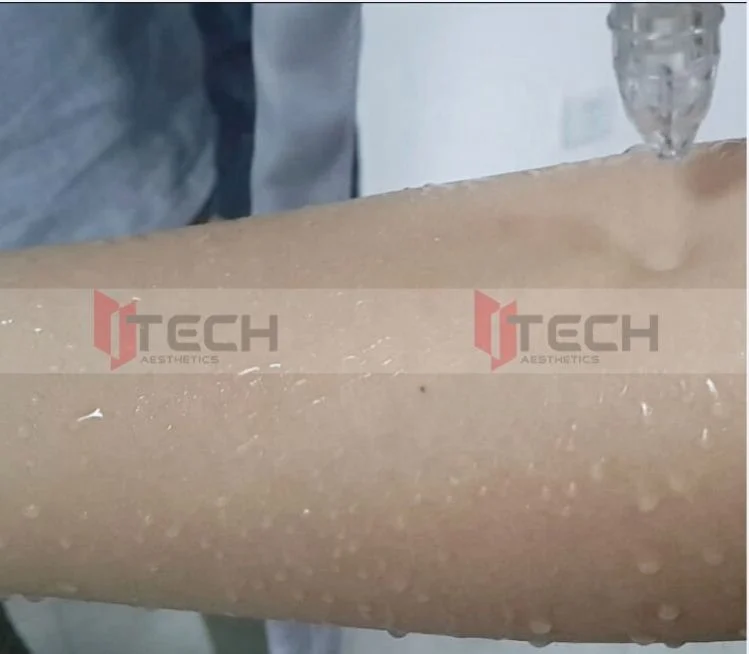  Новая Кислородная Маска для воды Jetpeel H200 Jet Peel машина очистки