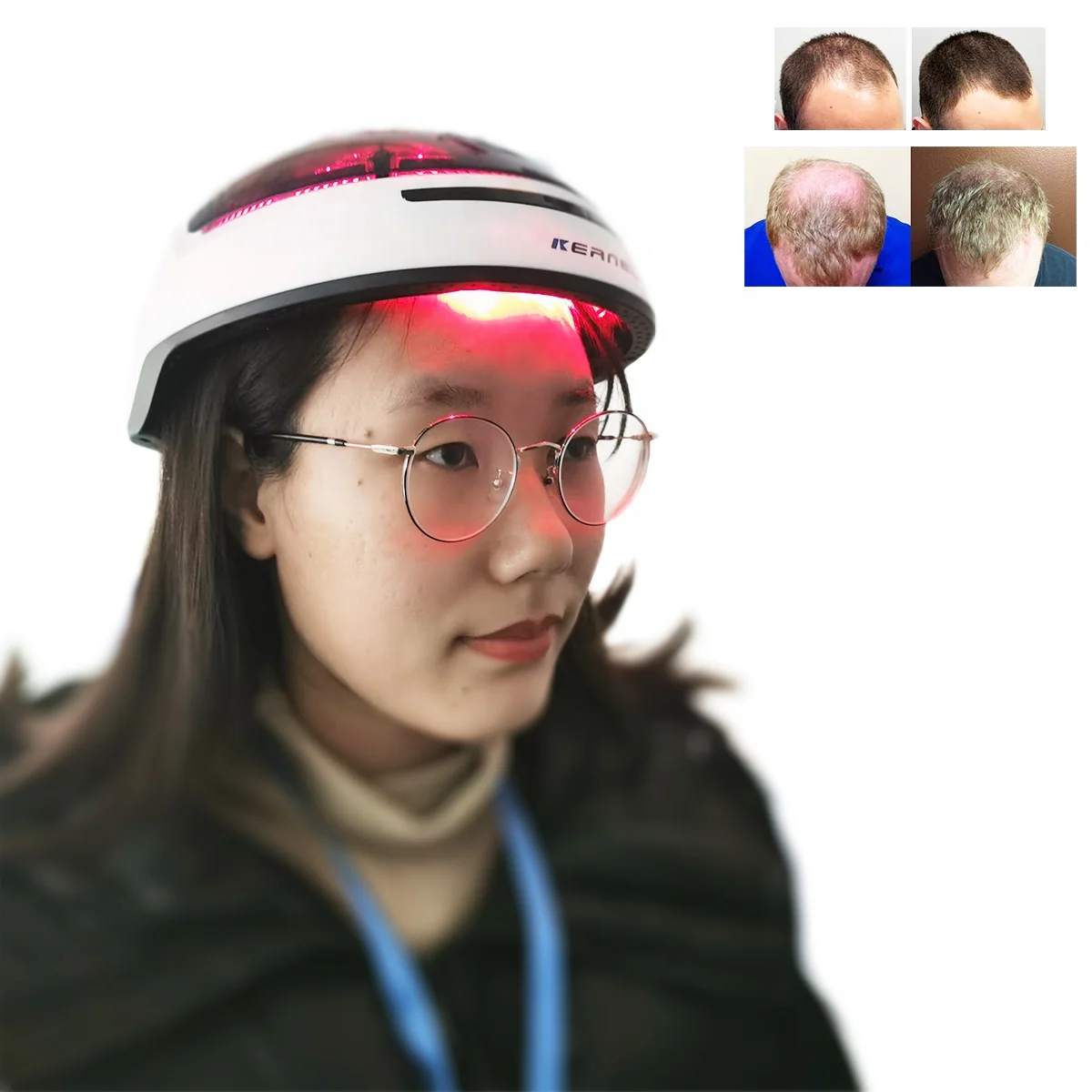 Kernel laser hair growth helmet Medical 650nm Diode Laser Hair Stimulation Growth Device For Hair Salon Use