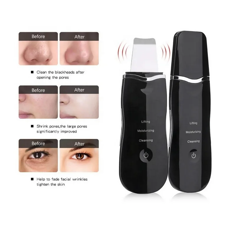 Facial Cleaning Electric Waterproof Rechargeable Face Peeling Nano Vibrating Scraper Spatula Ultrasonic Skin Scrubber