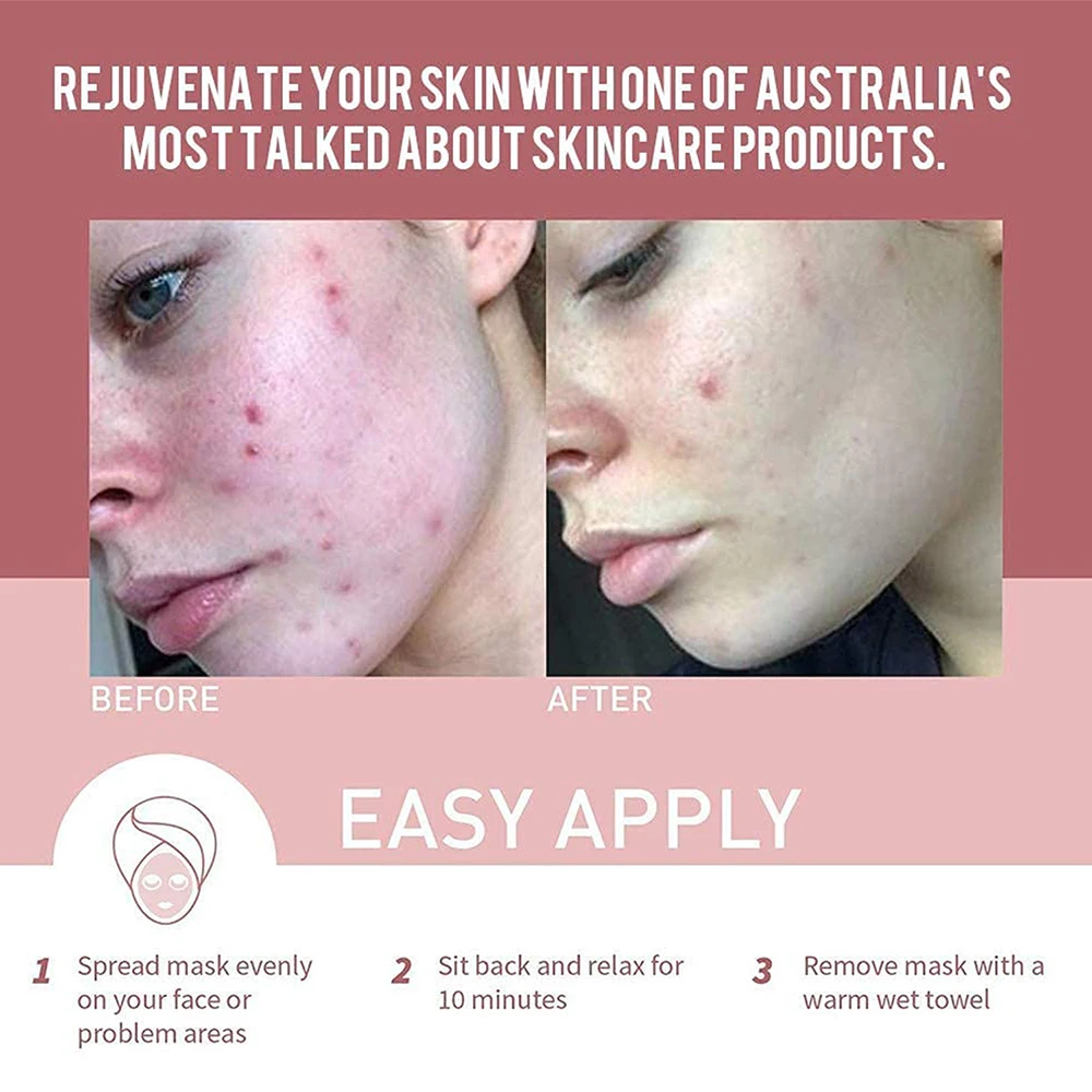 Organic Facial Acne Cleansing Moisturizing Whiten Face Mask Pink Clay Mud Masks Vegan Australian Private Label Claymask Beauty