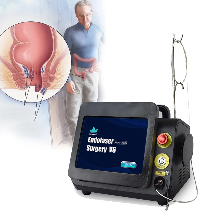 Super supplier 980nm 1470nm  diode laser hemorrhoids machine for proctoloy