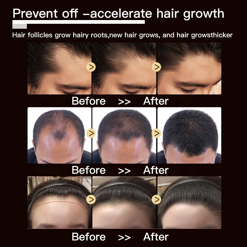 Private Label Natural Organic Hair Care Loss Treatment Serum Anti Hair Loss Promote Hair Growth 7 Days Ginger Essential Oil