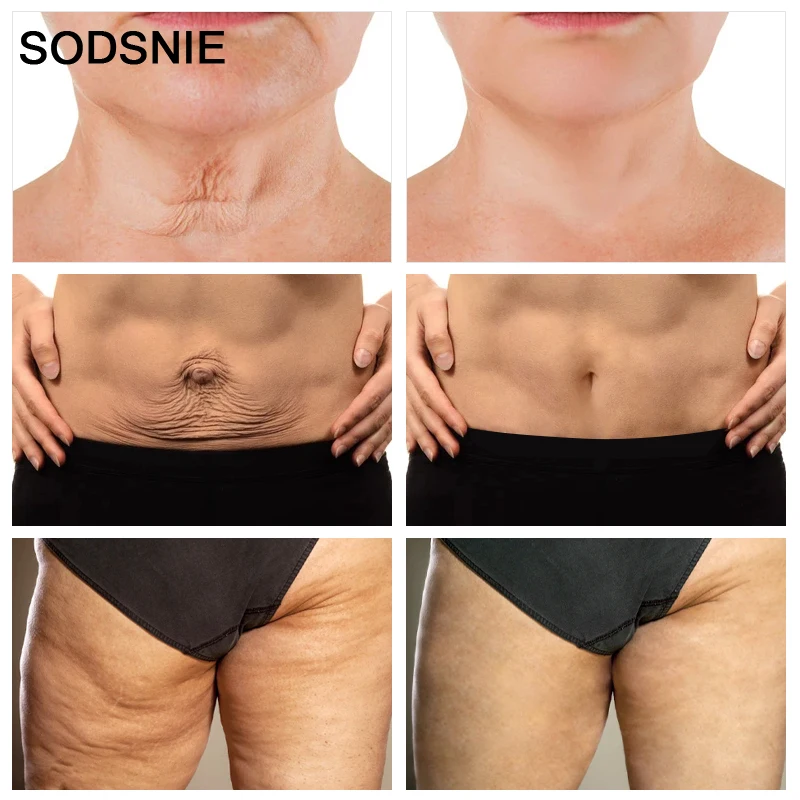 SODSNIE Retinol Anti-aging Body Cream 50g Box Adults Hair Removal Cream Female Libido Enhancer Skin Care Repair Cream 3 Years
