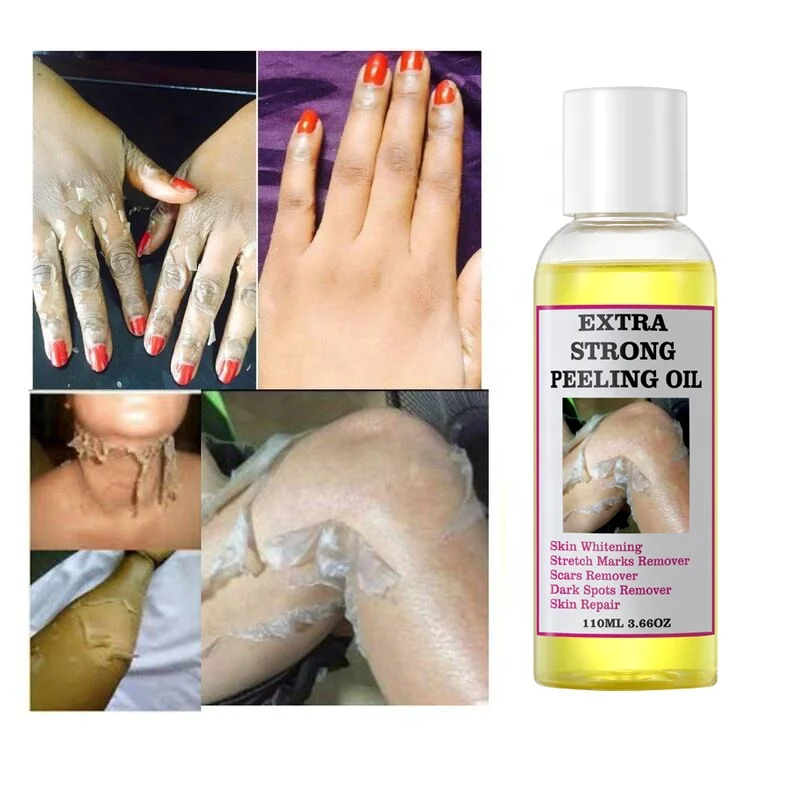 Extra Strong Peeling Oil Scar Remove Stretch Marks Whitening Yellow Peeling Oil