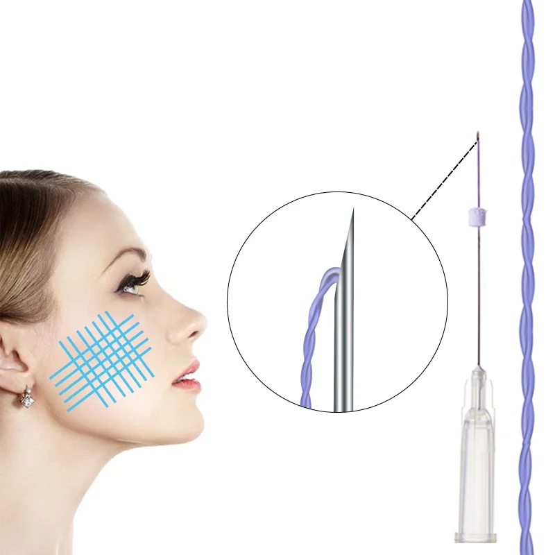 2023 skin beauty firming young suture material hot sale lasts a long time tornado tornado screw PDO thread from Korea