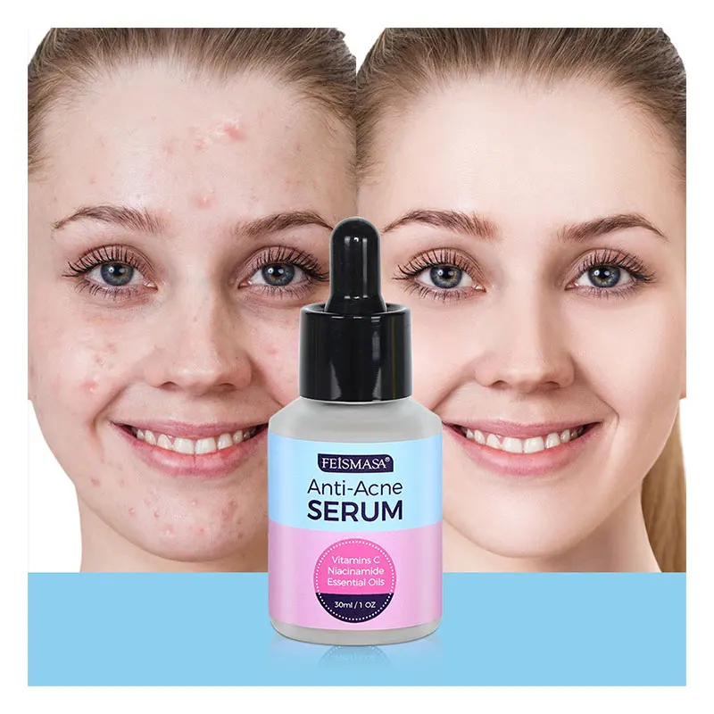 Niacinamide Hydrating Fruit Acid Salicylic Acid Vitamin C Anti-Acne Serum For Face