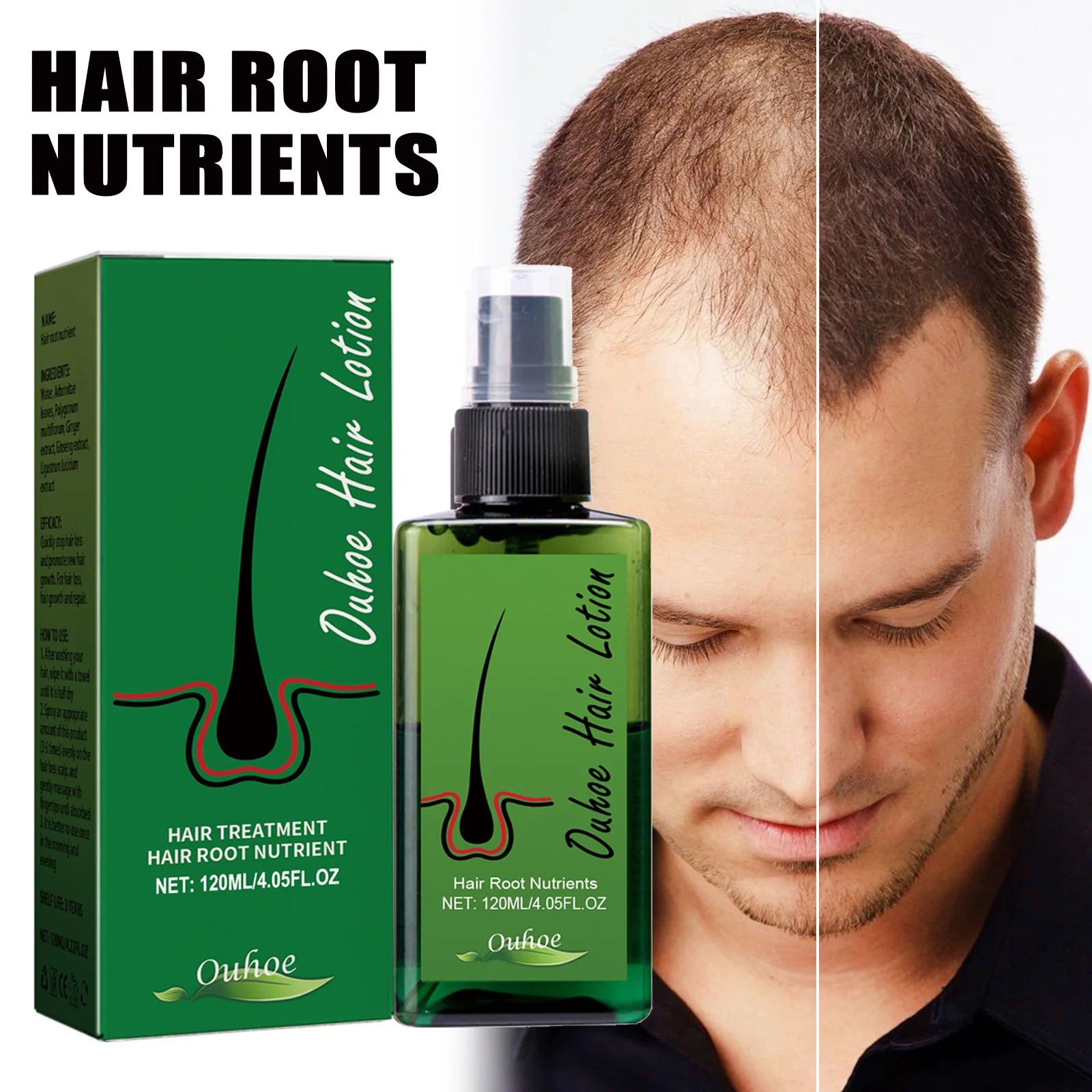 2024 Factory wholesale hair repair regeneration spray 120ml, suitable for men and women bald hair oil