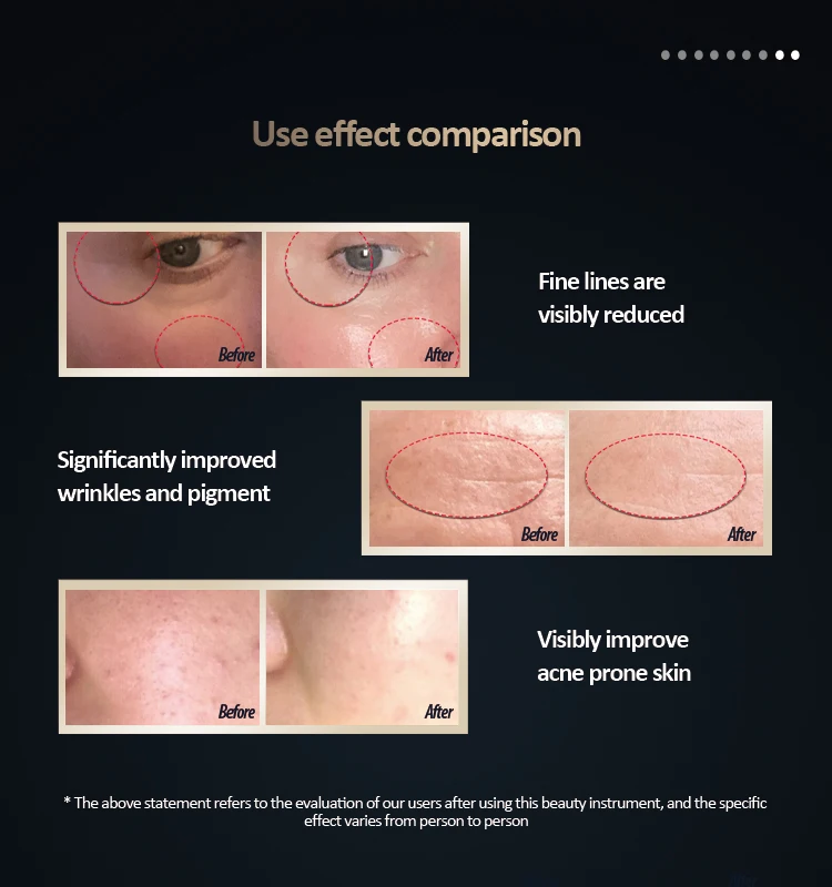 2022 New multifunctional tricolor laser beauty instrument for home use