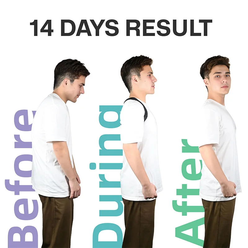 Custom Posture Corrector Brace Back Straightener Belt Shoulder Support Lumbar Back Braces Posture Corrector