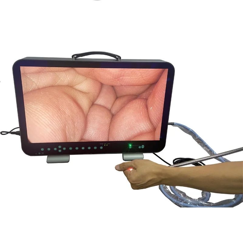 All In One Portable FHD Image System Endoscope Portable Endoscopic Camera With 27inch Monitor E33