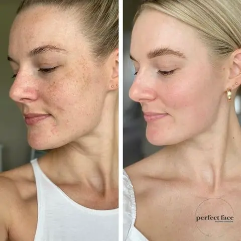 OEM/ODM Hot Sale Collagen Kojic Acid Serum Indonesia Niacinamide Whitening Anti-aging Facial Serum 30ml