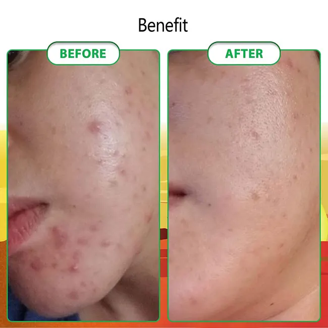 Natural Toilet Fresh Scent Soft Based Antiseptic Neem Aloe Vera Soaps