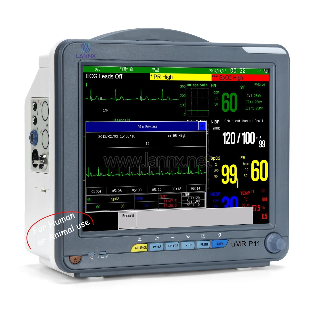 LANNX uMR P11 CE approved portable battery 6 parameter human or animal use Bedside monitor clinical medical cardiac Monitoring
