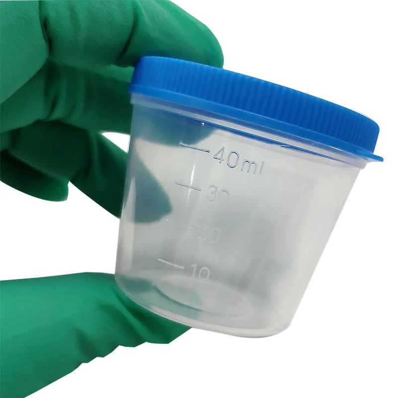 Disposable plastic urine container 40ml Sizes Urine Specimen Cups