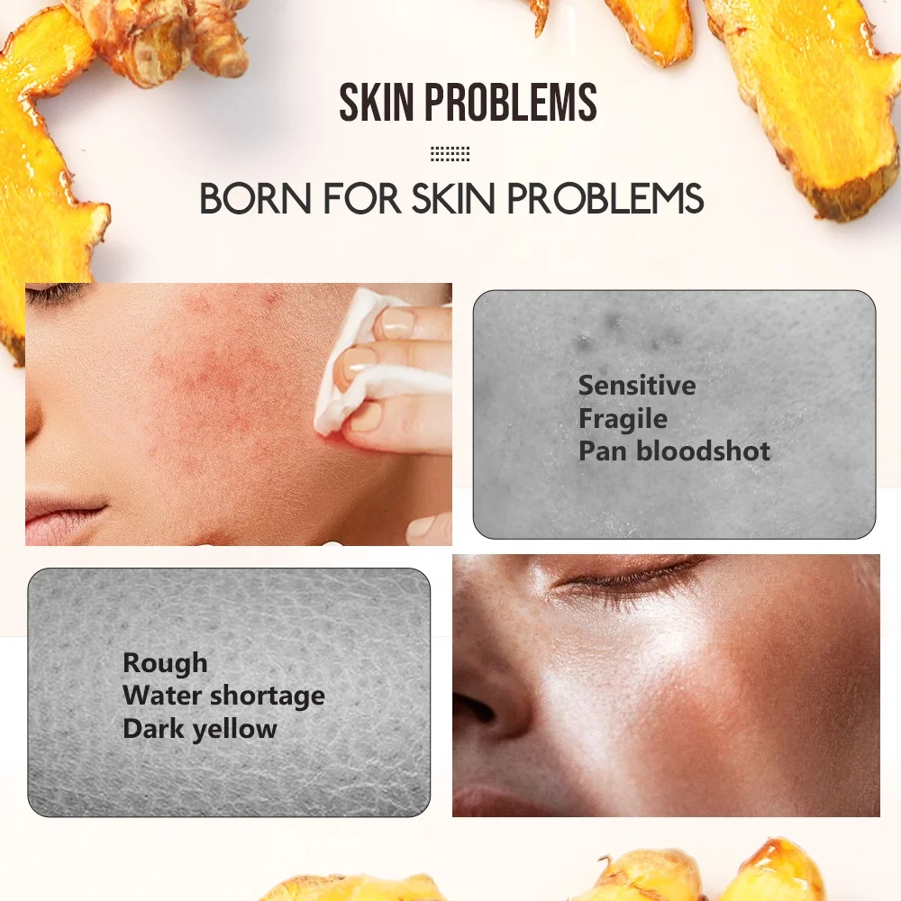 OEM Vegan Tumeric Extract Serum Anti Acne Skin Lightening Reducing Dark Spots Turmeric Face Serum