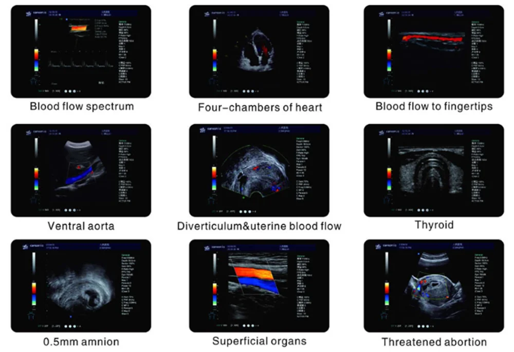 Ультразвуковой аппарат