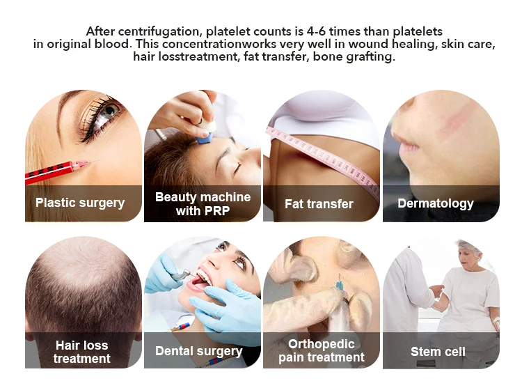 MANSON PRP Tube With Anticoagulant Stem Cell P Shot Near Me PRP Rich Plasma Platelet Rich Intraosseous defect