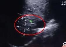 
2020 New Mini Wifi Color Doppler 7.5/10MHz Ultrasound Machine / Wireless Linear Probe 