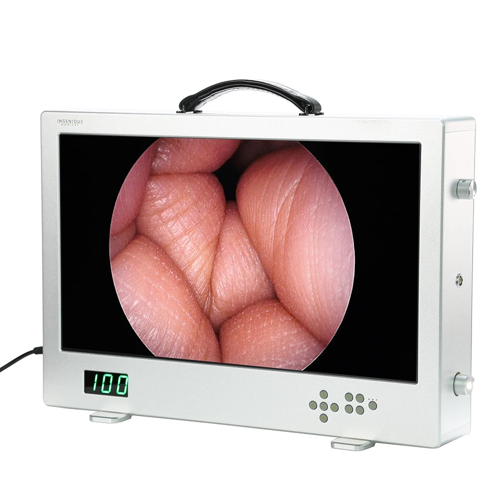 1080P 24 inches 4 in 1 Integrated Medical Diagnostic Equipment Video Camera System, all in one Portable Hd Endoscope Camera