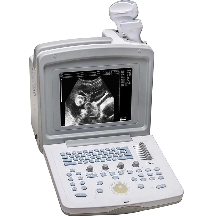 YSB180V Ysenmed Portable veterinary animal ultrasound scanner pets health ultrasound vet surgical ultrasound