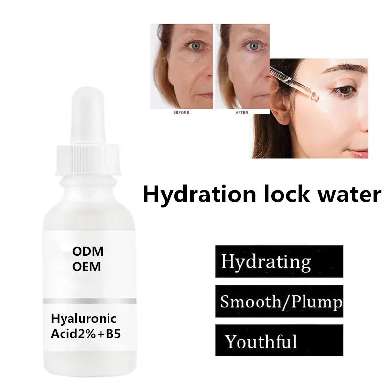 Hot sell Niacinamide 10% zinc 1% peeling solution Salicylic acid 2% ordinary serum