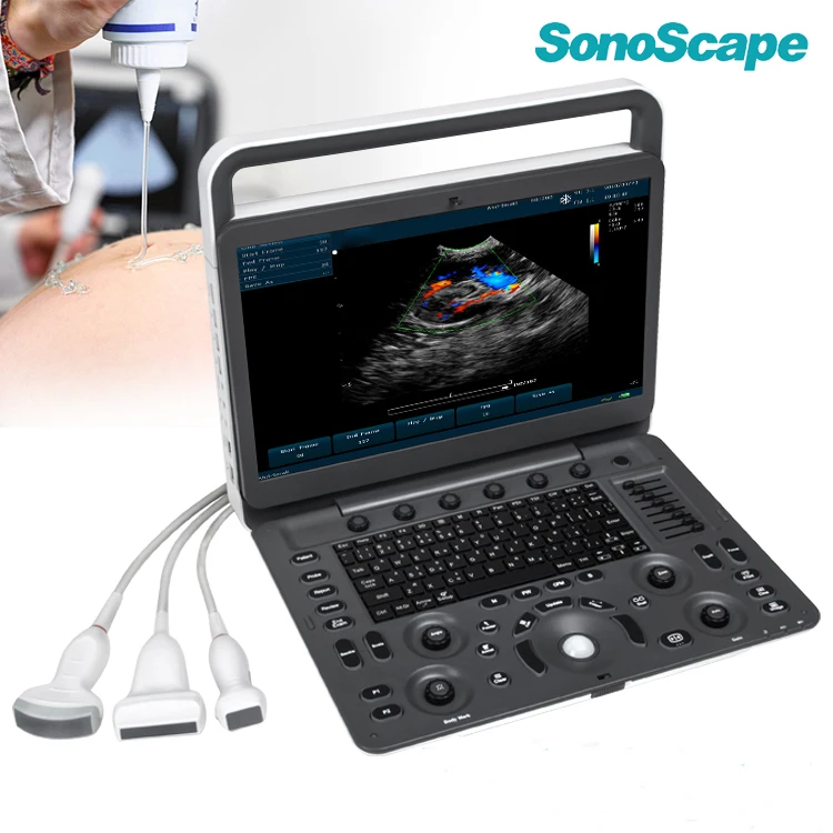 Sonoscape e1 exp ecografo 4d abdominal / Vascular / GYN/OB Cardiac ultrasound machine