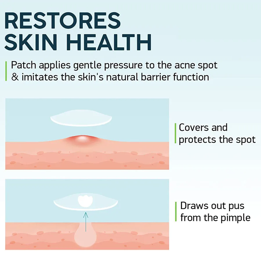 Small Circle Acne Patch Wholesale Star Acne Pimples Patches 12dots 18dots 20dots 24dots 36dots for skin