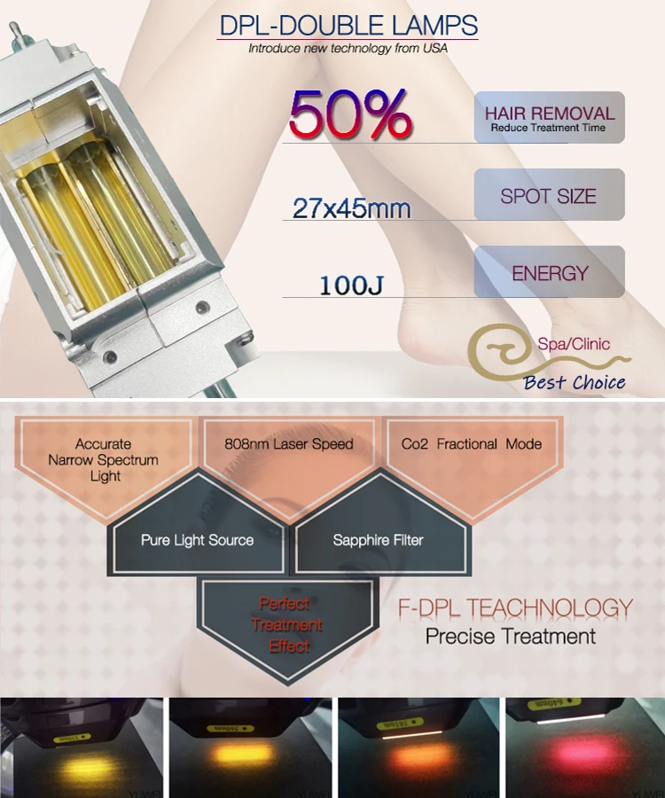 China Supplier Permanent Unhairing Handpiece Protect Design Ipl DPL Hair Removal DPL Machine