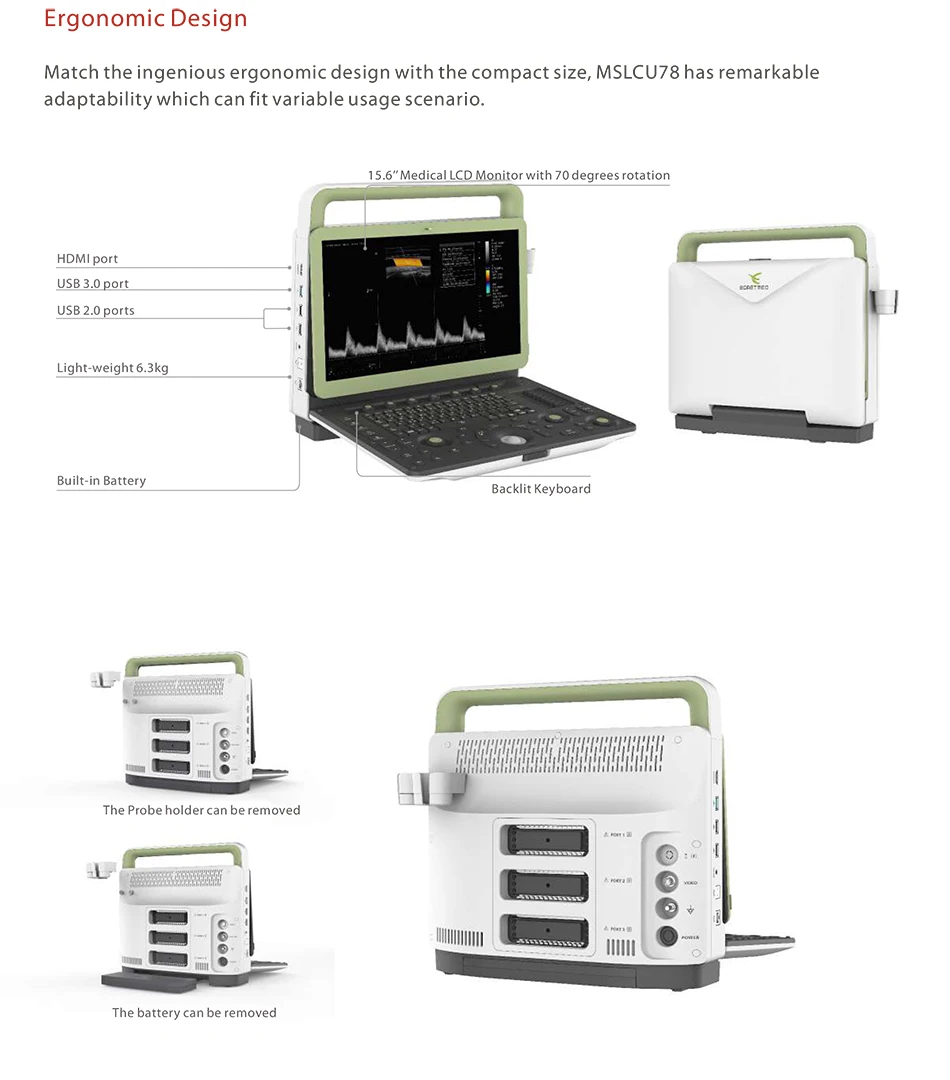 15.6 Inch Portable Color Doppler System Medical 4D Ultrasound Machine for Pregnancy