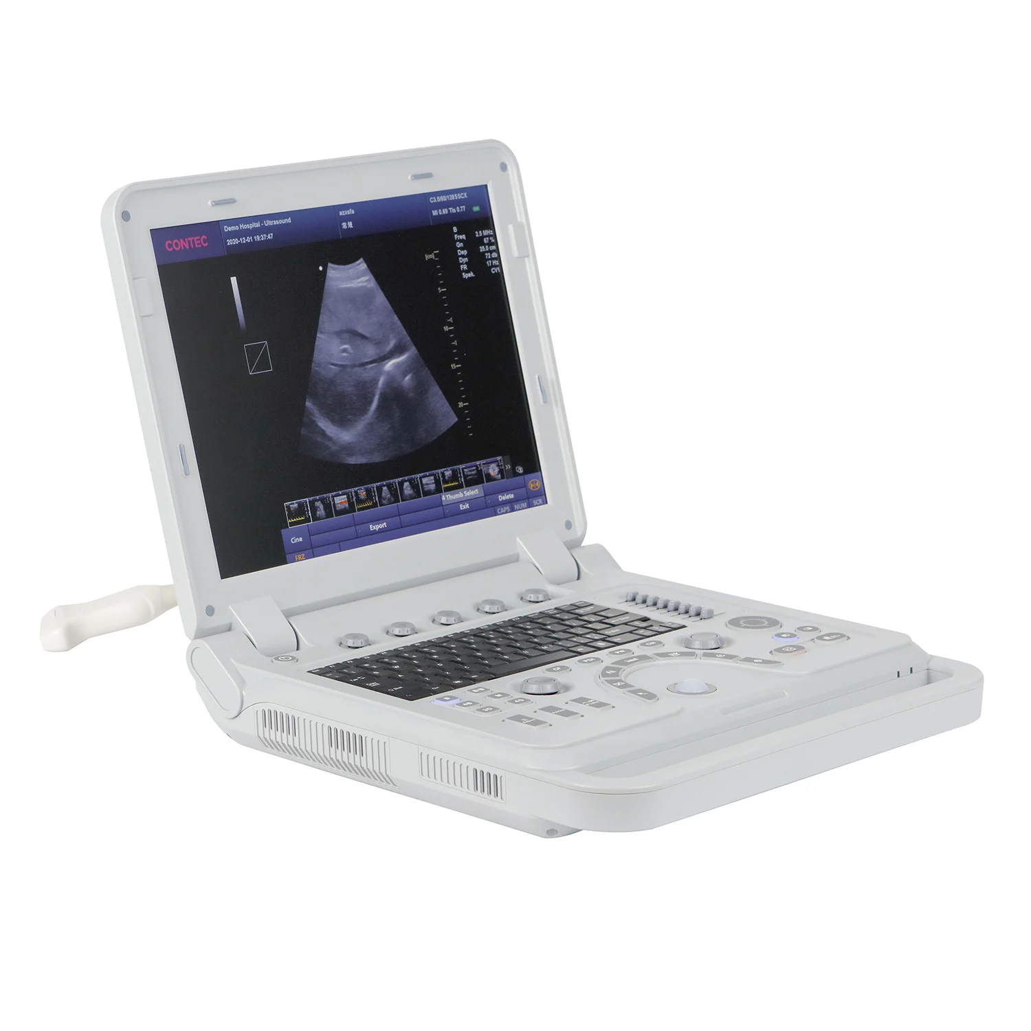 CONTEC CMS1700A Color Doppler USG Color Ultrasound Scanner Diagnostic Machine Systems Convex Probe