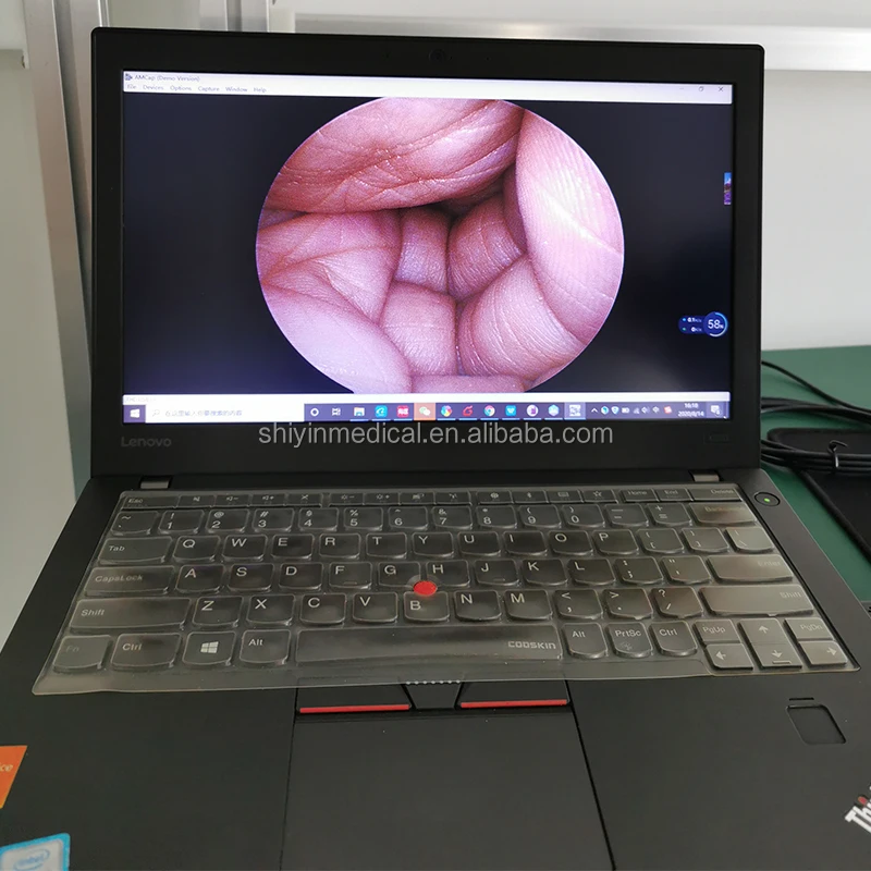 Новое поступление, портативная камера-эндоскоп HD USB для обследования и хирургии