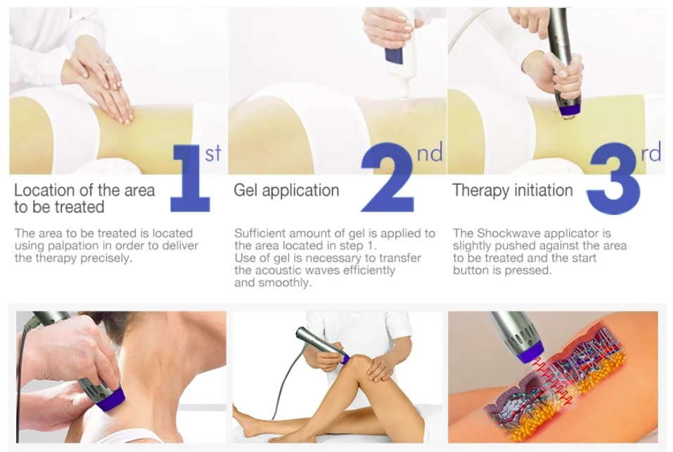2024 double channel ED therapy electromagnetic shock wave machine extracorporeal shockwave device for physical therapy