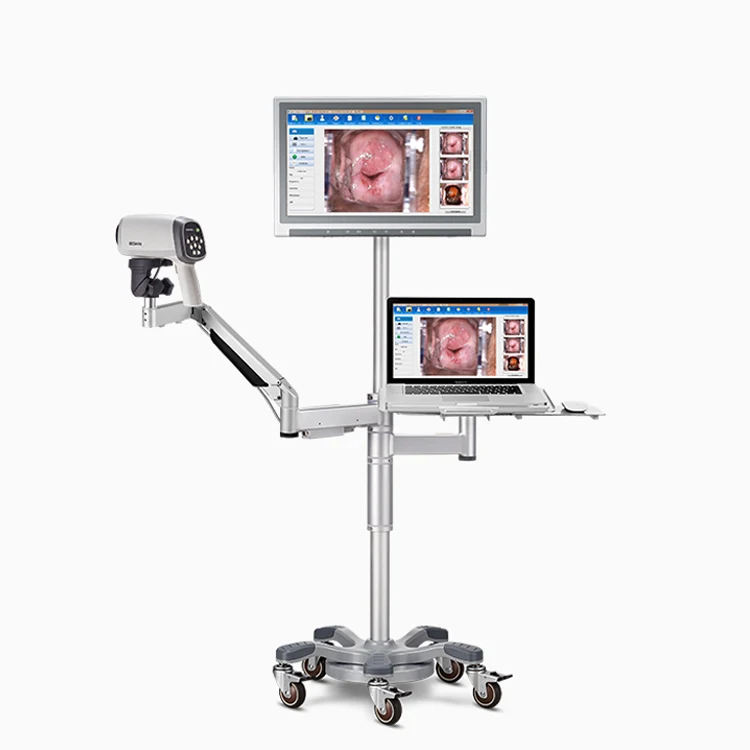 Edan C3 C6 C3A C6A Digital Video Colposcope HD High Definition Digital Imaging Vaginal Colposcope for Gynecology