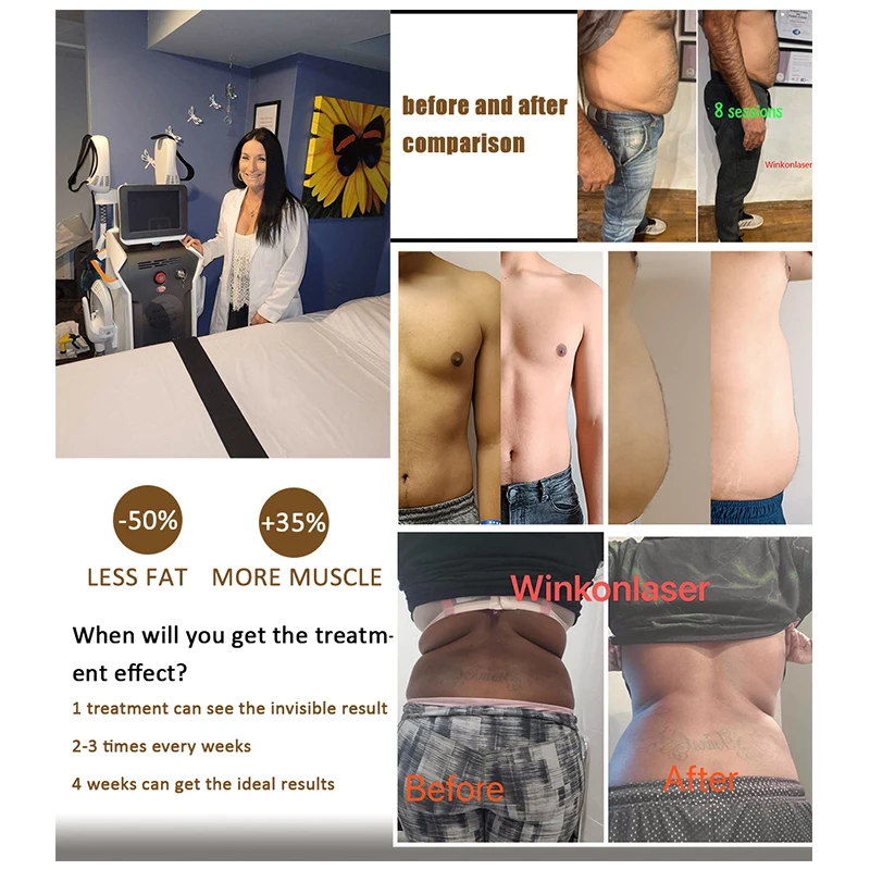 Winkonlaser Ems Neo Body Sculpt Fat Reduction Butt Lifting Fat Burning Muscle Build Manufacturer Fat Reduction Ems Rf Machine