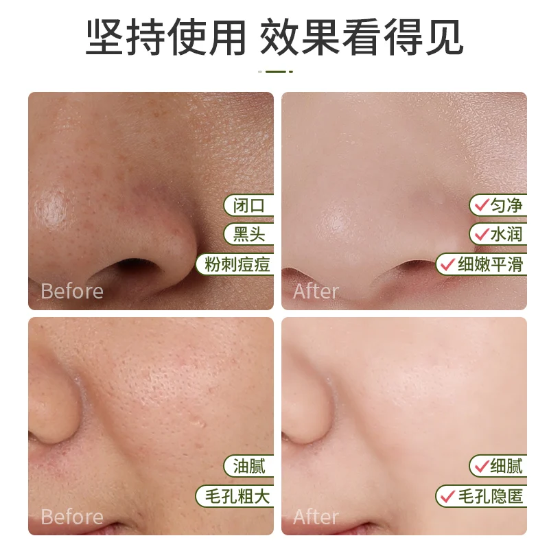 Factory  wholesale  best price  rosemary plant extracts for hair/face/skin care  makeup  setting rosemary hydrosol