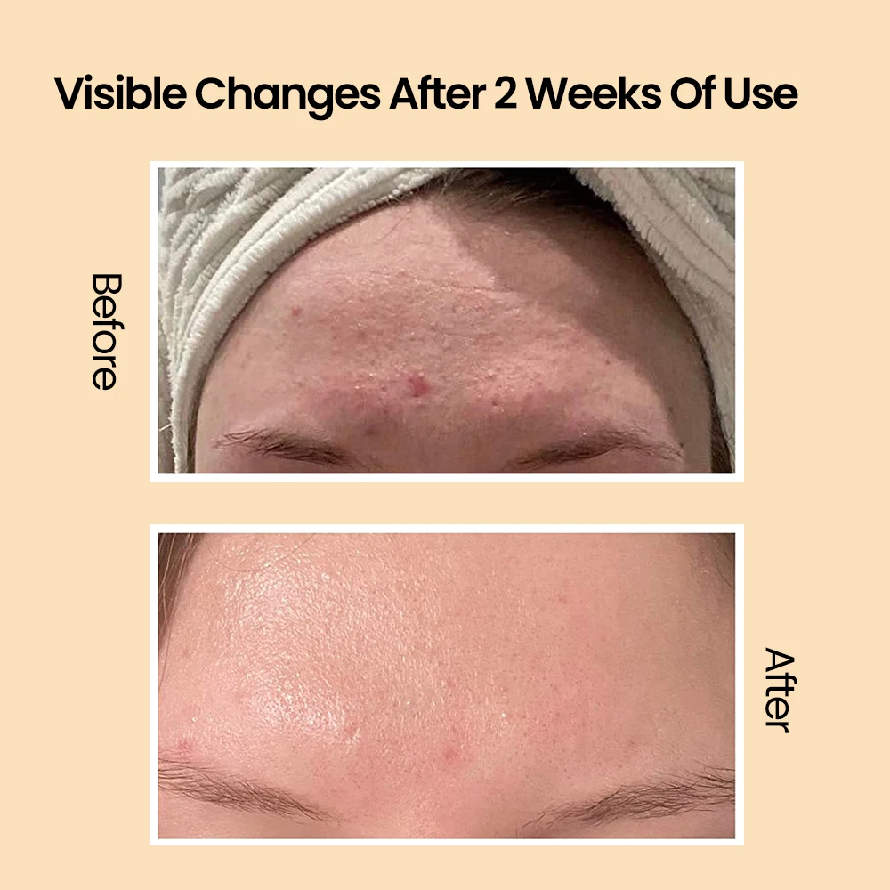 In Stock Factory Price Korean Cosmetics Skin Anti Aging Wrinkles Smoothing Pump Snail Mucin Face Serum Skin Care Serum(New)