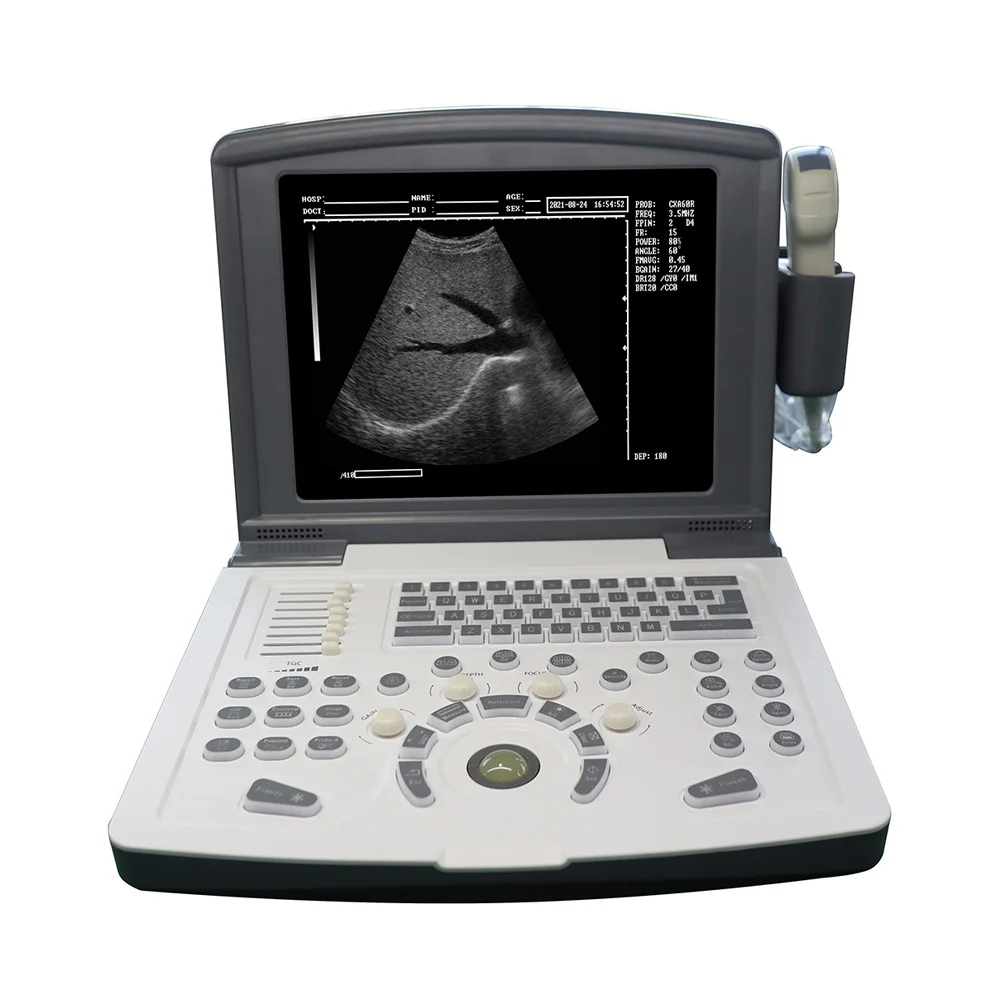 RUIHUA full digital portable ultrasound scanner