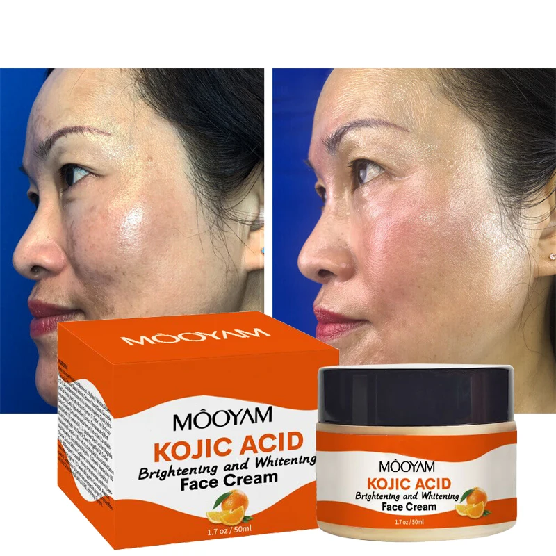 Best Natural Kojic Acid Brightening And Whitening Face Cream Orange Peel Oil Vitamin C Remove Dark Spot Facial Cream