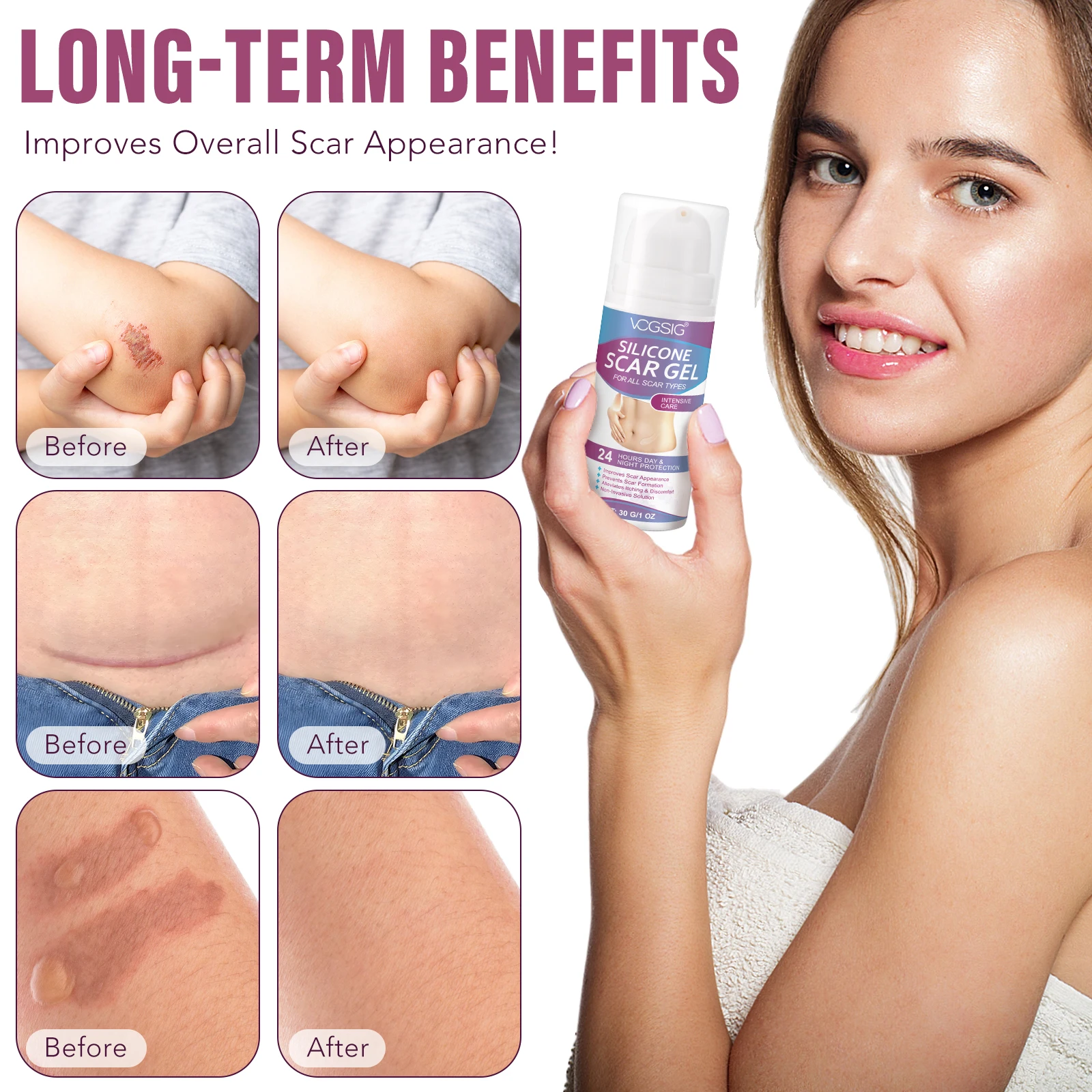 Best Selling Skin Care Scar Removal Gel Premium Face Body Pimples Acne Remove Scar Remover Gel for All Scar Type