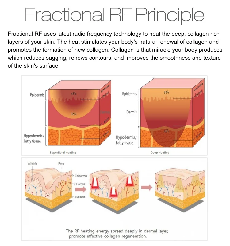 SVATAR 5 Mhz high frequency facial Fractional RF face lift rf device facial skin tightening body shaping machine