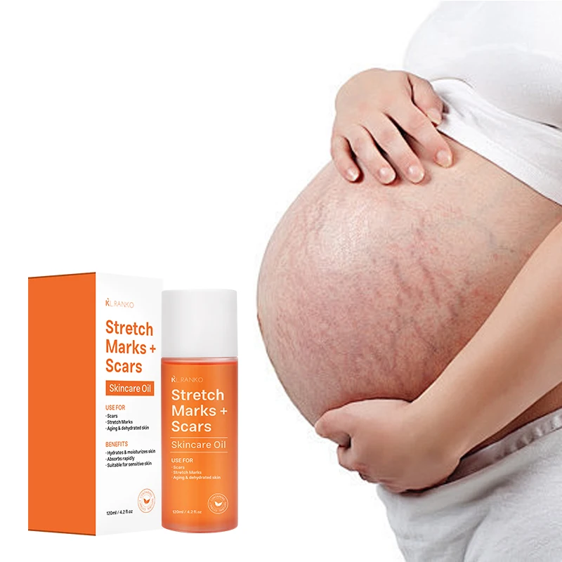 OEM Private Label Natural Stretch Mark Moisturizer Repair Oil Pregnancy Stretch Marks Scar Removal Female Skin Care Product